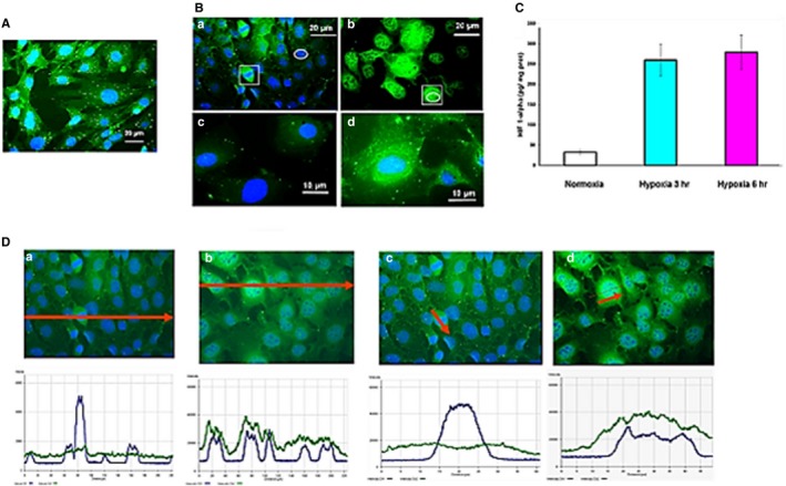 Treatment of hypoxia‐dependent cardiovascular diseases by myo‐inositol ...