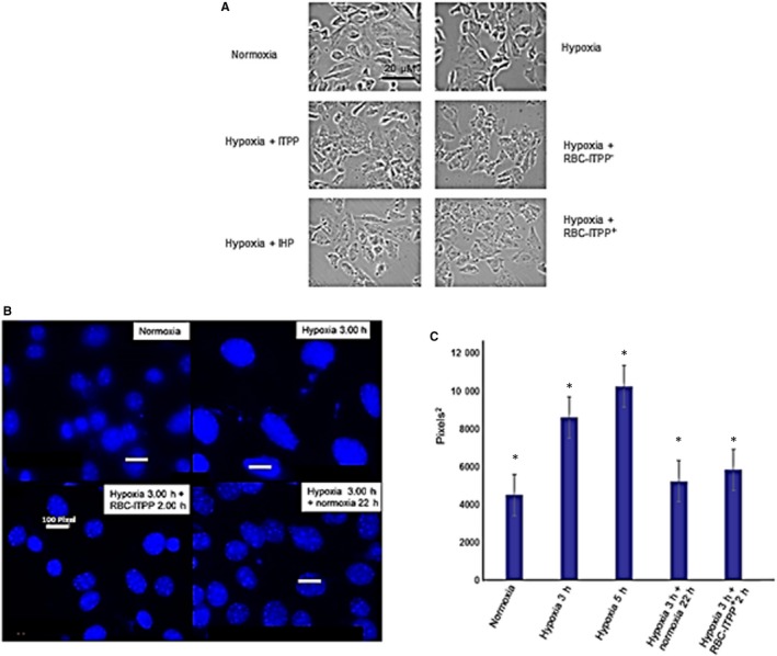 Treatment of hypoxia‐dependent cardiovascular diseases by myo‐inositol ...