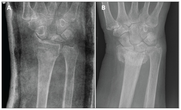 Fig. 5