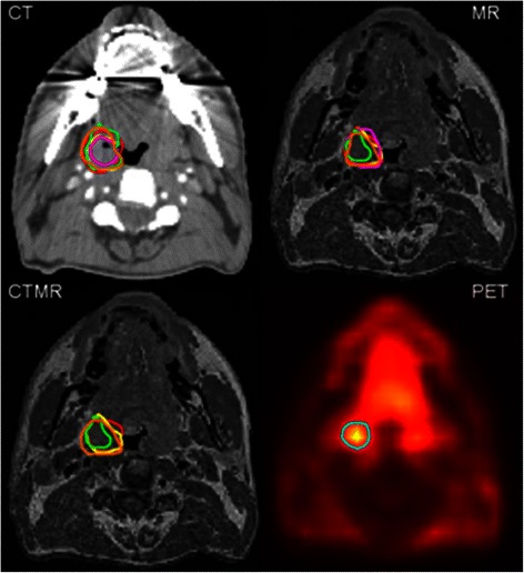 Fig. 1