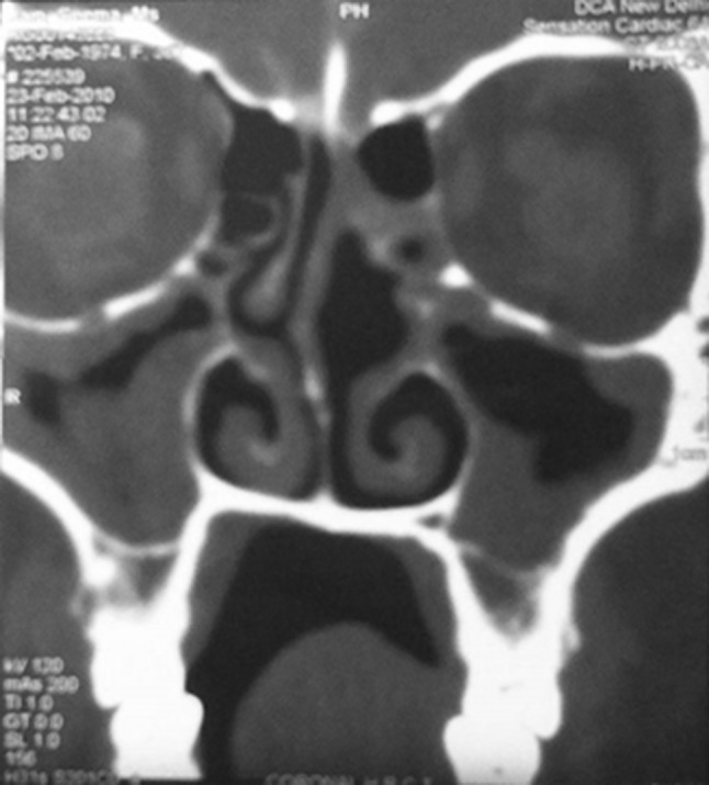 Fig. 1