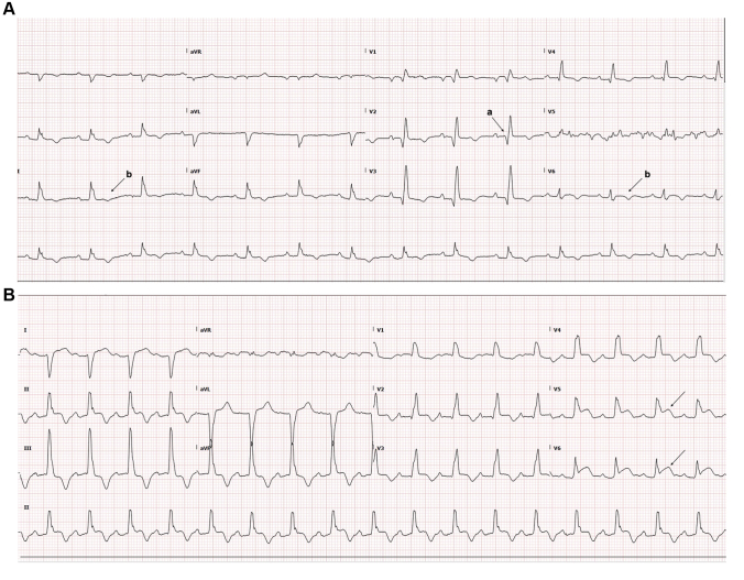 Figure 2