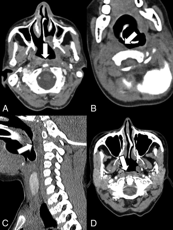 Fig 2.