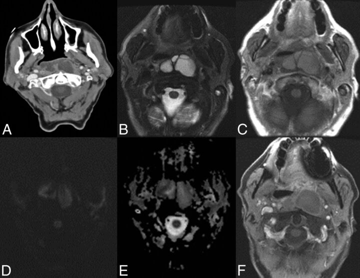 Fig 3.