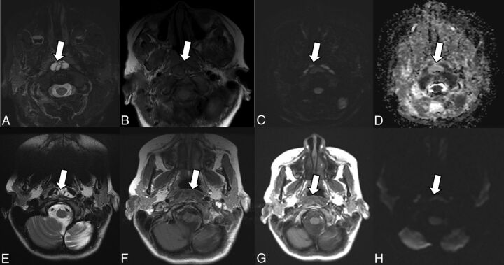 Fig 4.