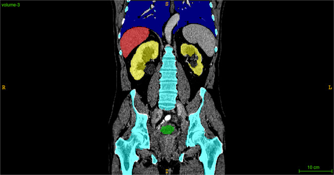 Fig. 3