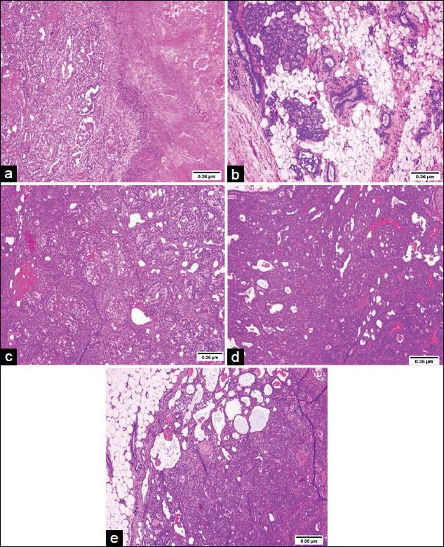 Figure-2
