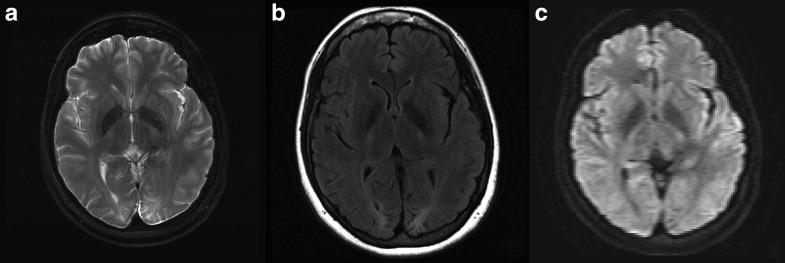 Fig. 1