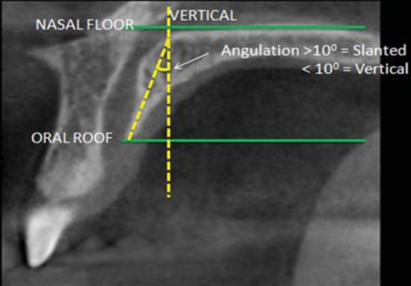 Fig. 6