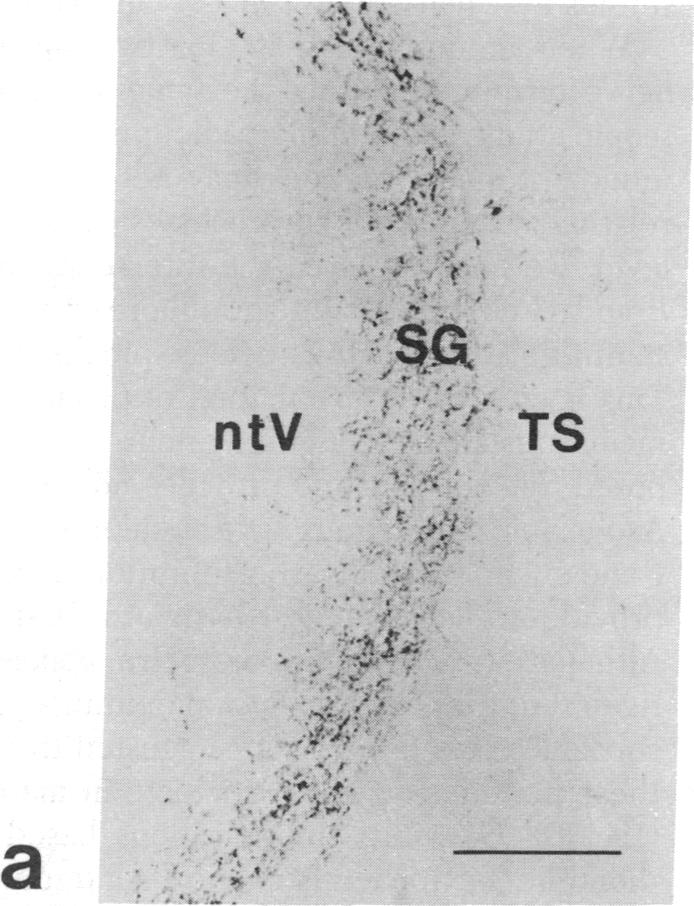 graphic file with name pnas00441-0467-a.jpg