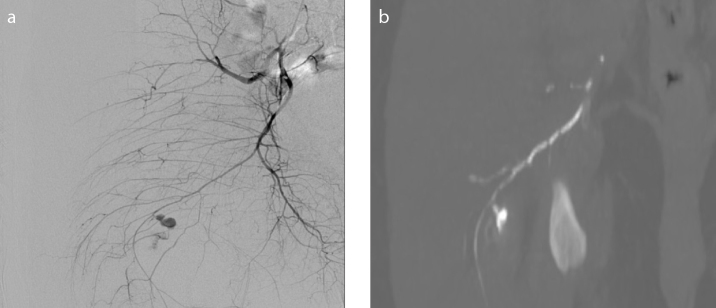 Figure 1. a, b