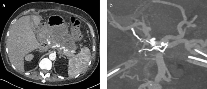 Figure 3. a, b