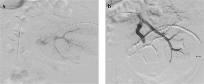 Figure 2. a, b