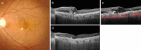 Fig. 13
