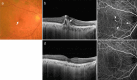 Fig. 14