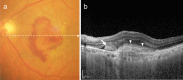 Fig. 10