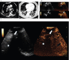 Fig.3