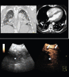Fig.2
