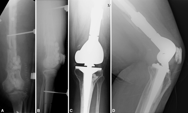 Fig. 2A–D