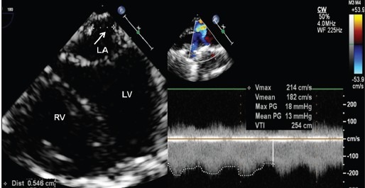 Figure 5