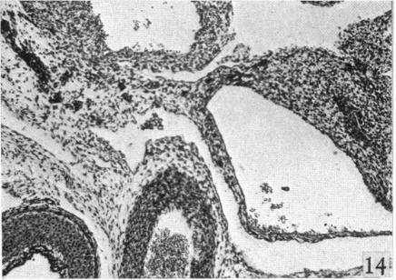 Fig. 14