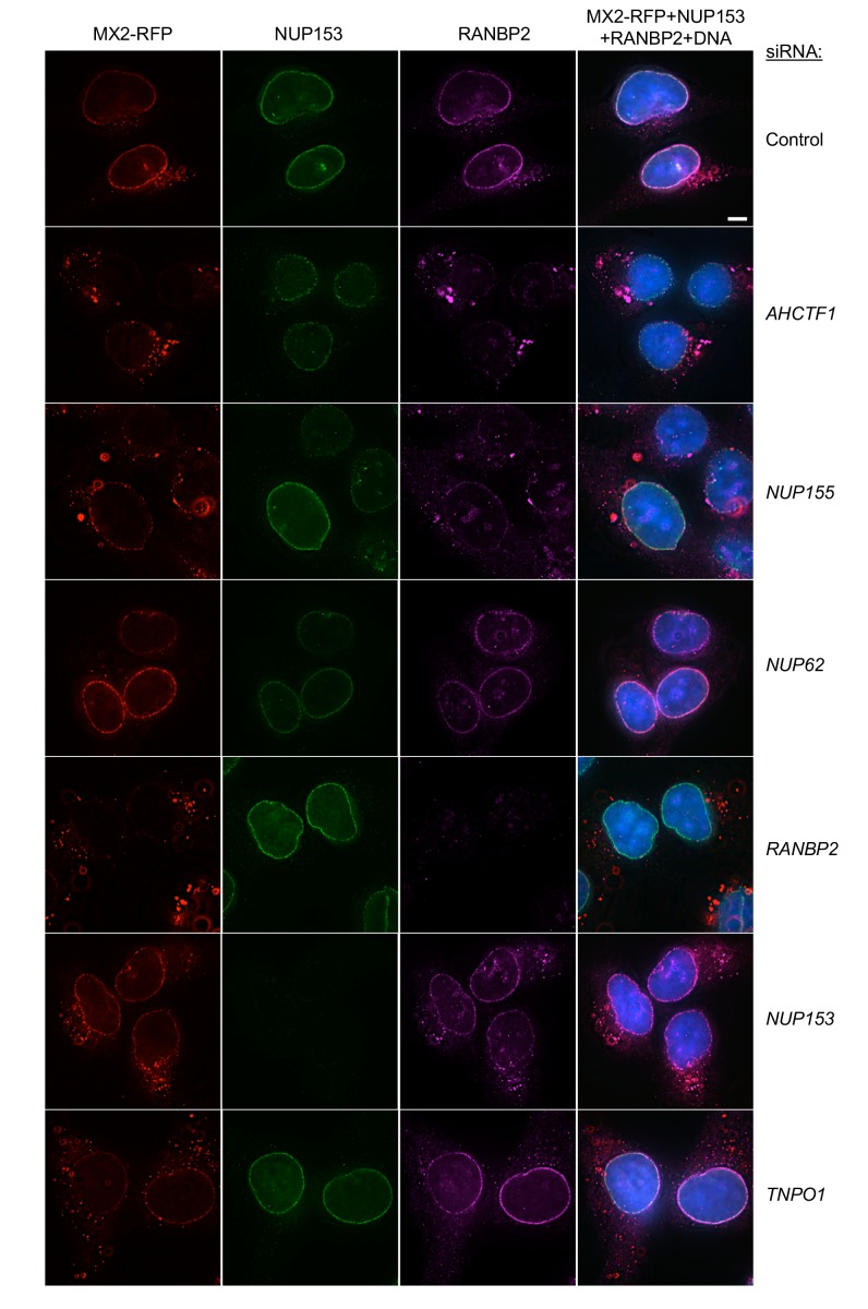 Figure 6—figure supplement 4.