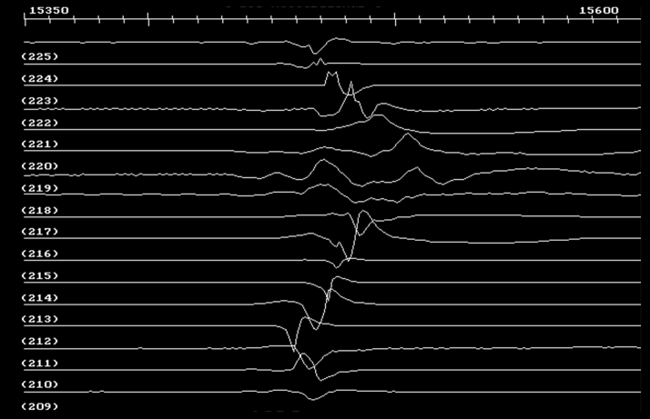 Figure 11