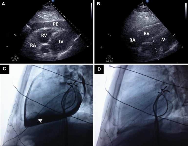 Fig. 1