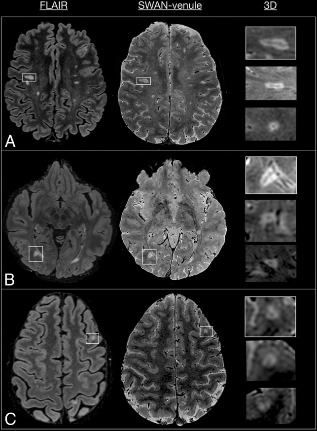 Fig 1.