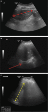 Fig 3.