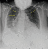 Fig 1.