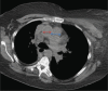 Fig 2.