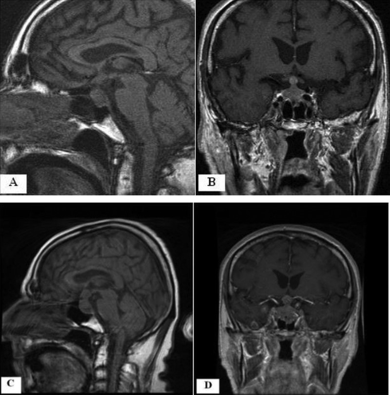 Figure 1