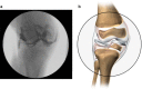 Fig. 3