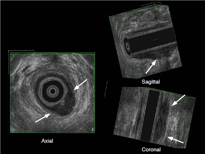 Fig. 13.