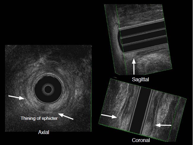 Fig. 14.