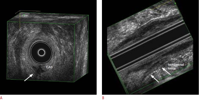 Fig. 11.