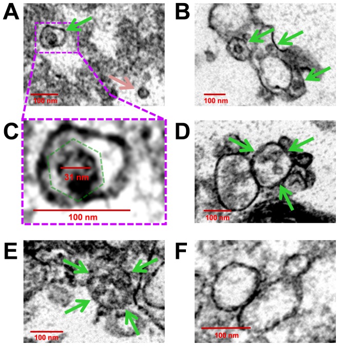 Figure 13