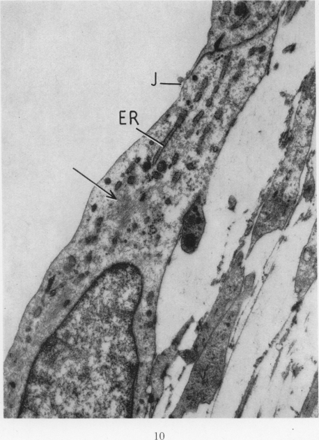 Fig. 10