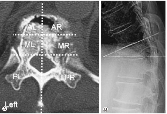 Fig. 14