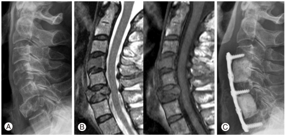 Fig. 16