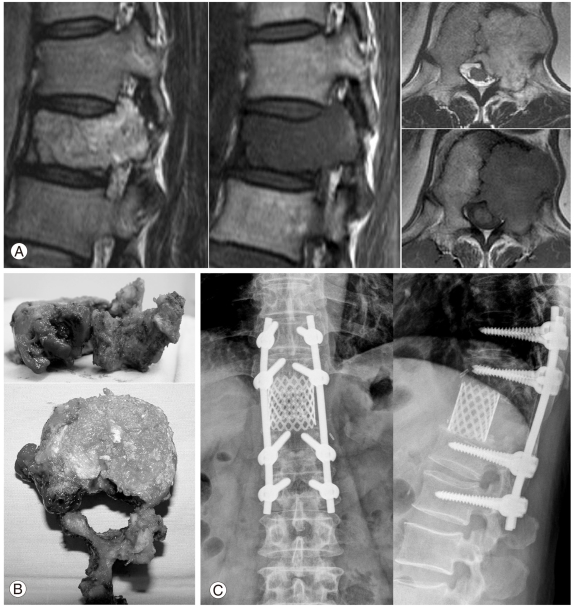 Fig. 17