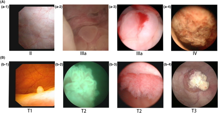 FIGURE 2