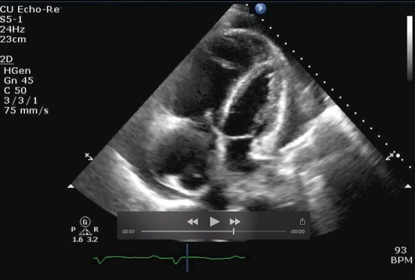 Figure 2