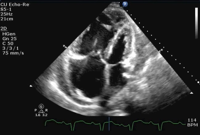 Figure 4