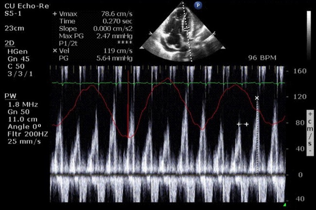 Figure 3