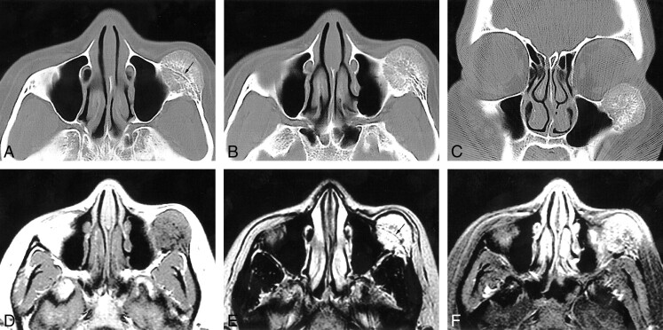 fig 1.