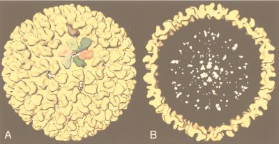 FIG. 35