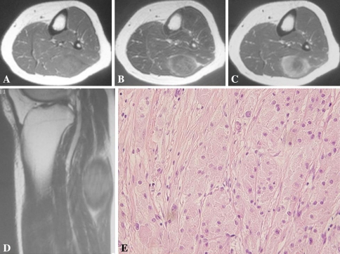 Fig. 1A–E