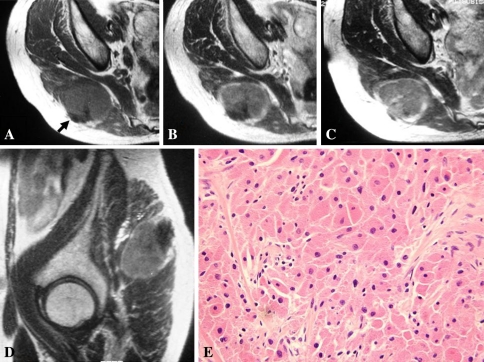 Fig. 2A–E